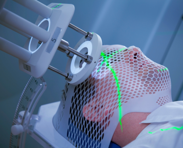 Radiotherapy Routine Radiation Therapy Planning – SK Radiology